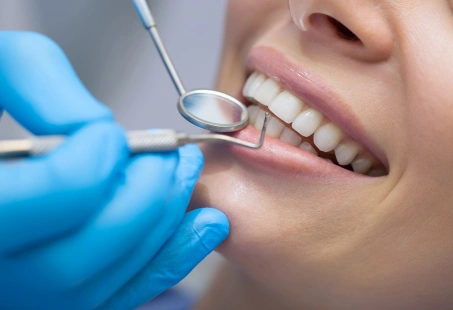 Smile Makeover: Benefits & 5 Ways In Which You Can Improve Your Smile