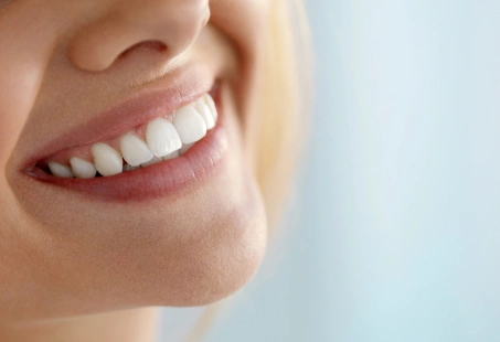 Veneers vs Lumineers: Everything You Need to Know
