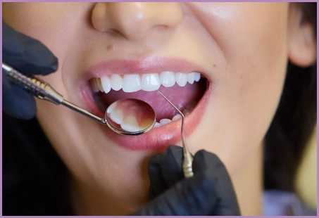 Bone Loss in Teeth: Causes, Signs and Treatment