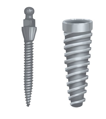 Mini vs traditional dental implants