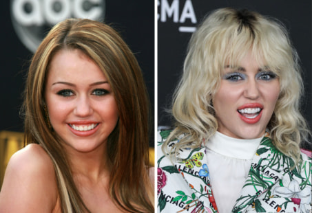 Miley Cyrus smile makeover