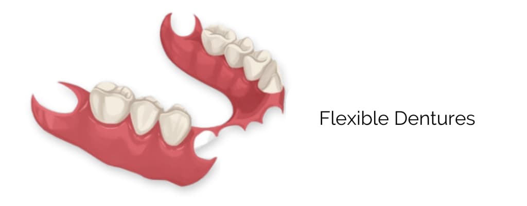 Flexible Dentures