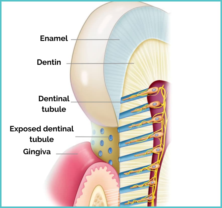Dentinal tubules and sensitivity
