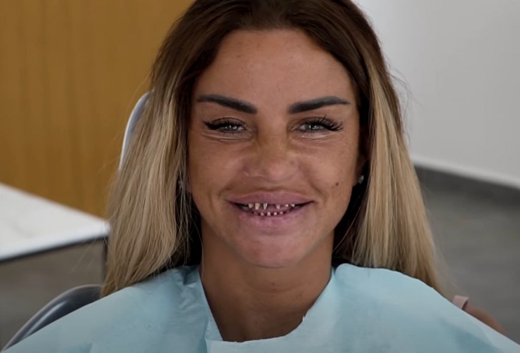 Katie Price teeth without crowns