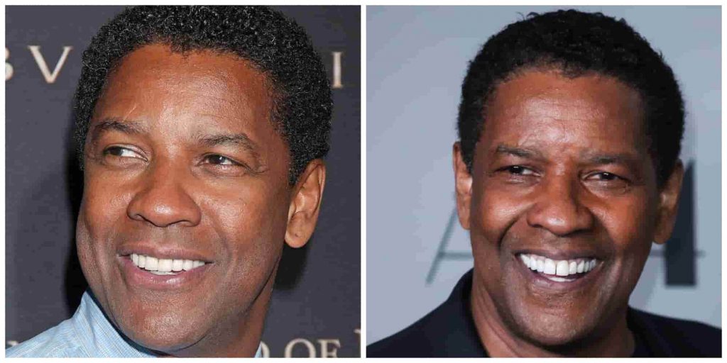 Denzel Washington teeth before and after