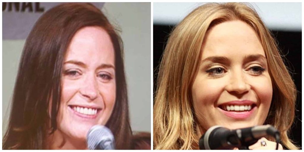 Emily Blunt teeth before and after