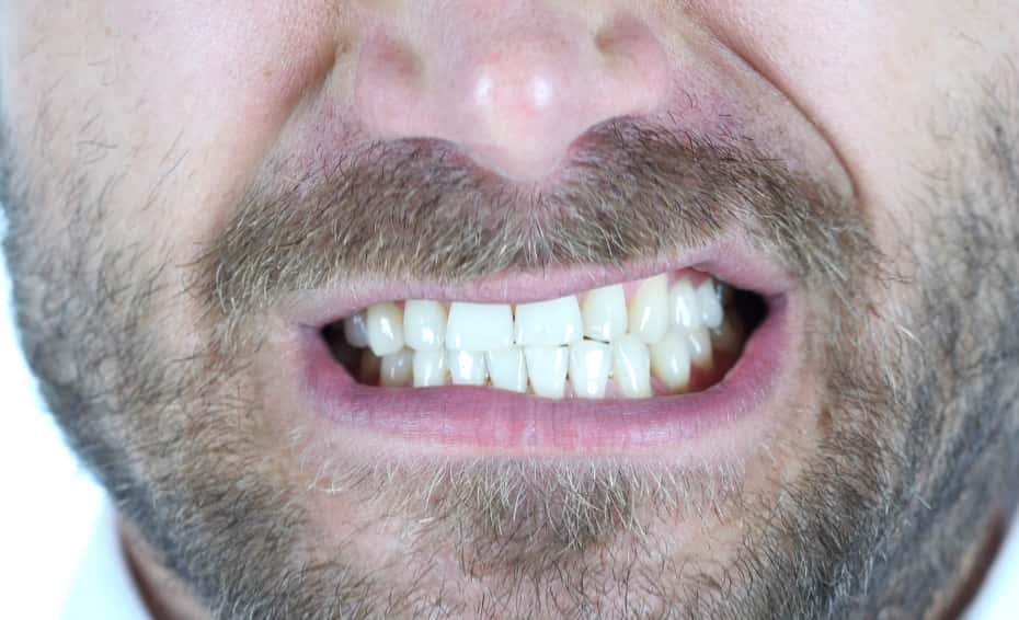 man clenching teeth