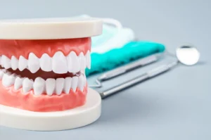 Snap On Veneers