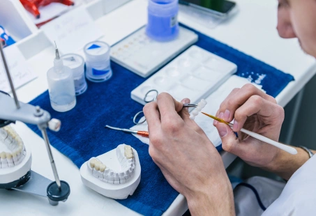 What Are Maryland Dental Bridges?