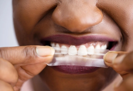 strip teeth whitening
