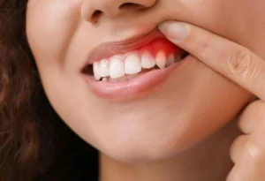 gum pain