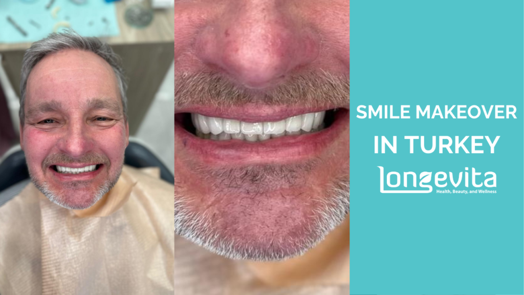 Gary Smile Makeover
