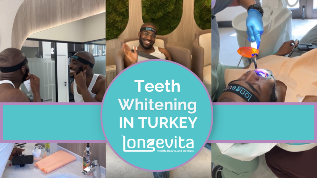 Jodeci teeth whitening